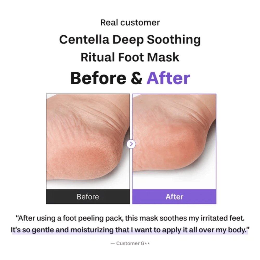 6. Baren Centella Deep Soothing Ritual Foot Mask – slika pred in po, ki prikazuje mehkejšo in bolj navlaženo peto po uporabi