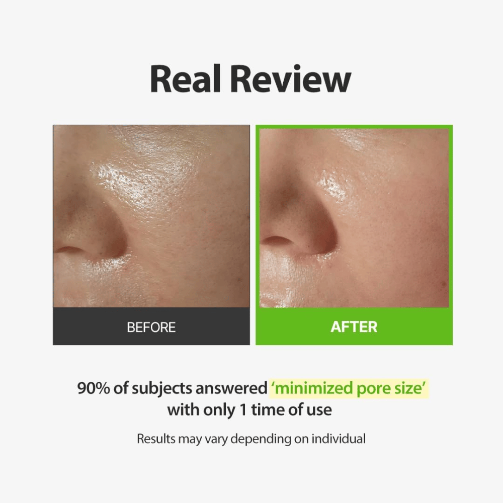 SUNGBOON EDITOR Green Tomato Pore Peeling Jumbo Pad – slika prej in potem s poudarkom na vidnih porah