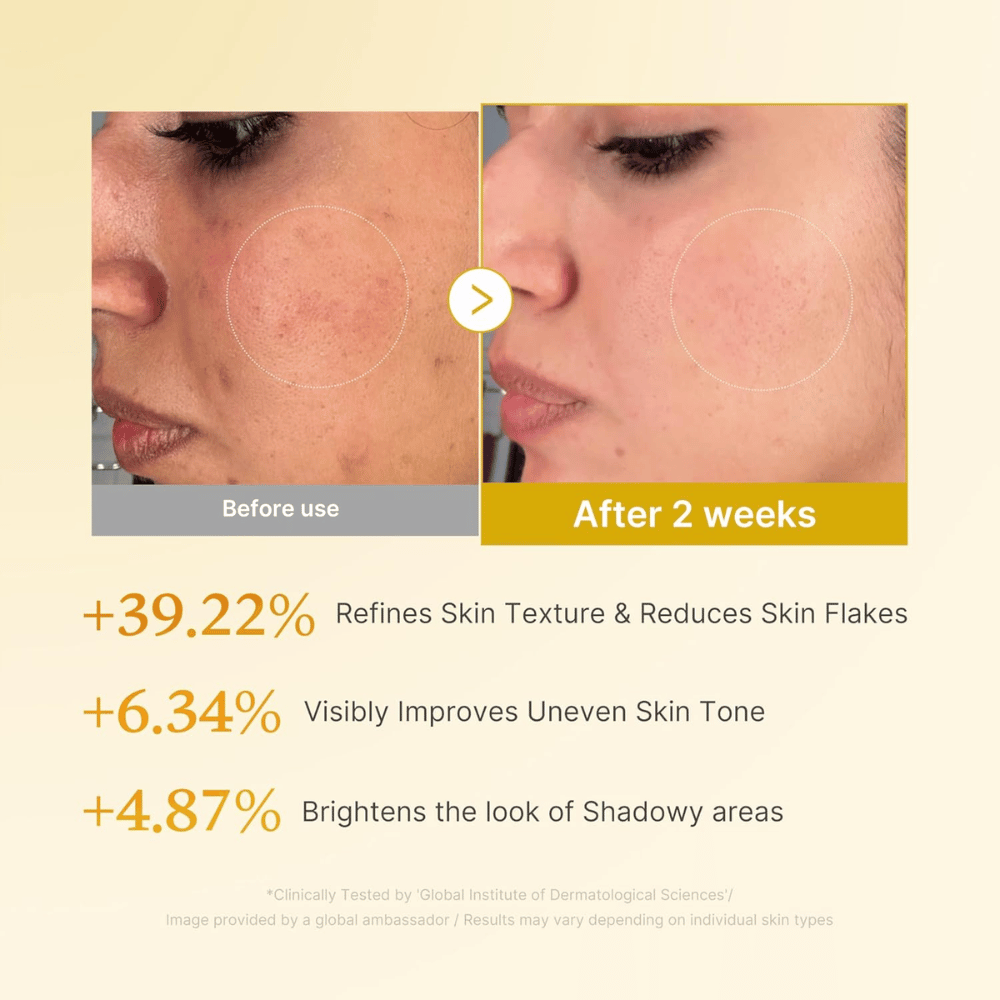Slika pred in po za Medicube Kojic Acid Turmeric Resurfacing Toner, ki prikazuje izboljšano teksturo kože, enakomernejši ten kože in zmanjšano suho luščenje kože po dveh tednih uporabe.