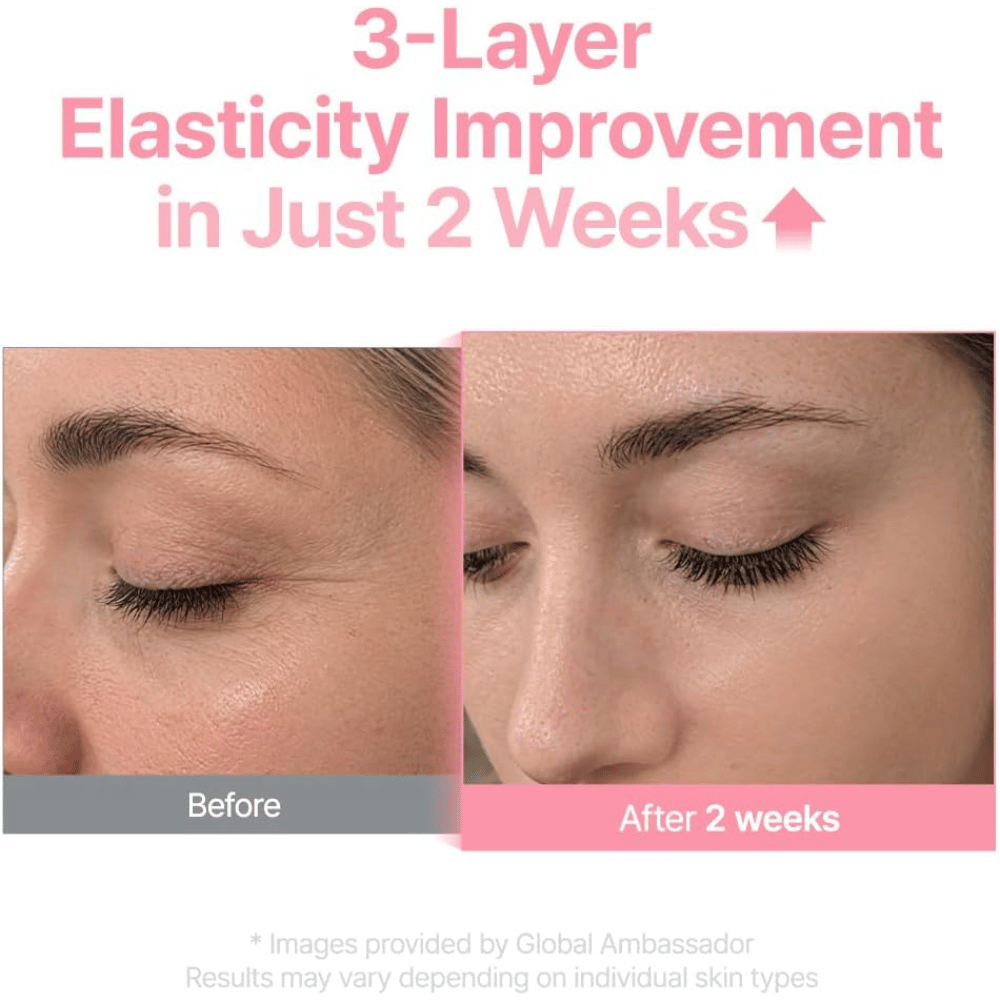 Slika pred in po za Purito Multi PDRN Collagen EGF Serum, ki prikazuje izboljšano elastičnost kože po dveh tednih.