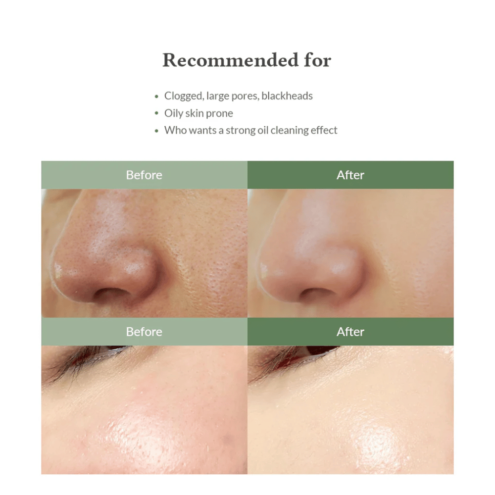 Dr. Althea Premium Quick Step Sebum Cleanser – čistilo za obraz, ki pomaga zmanjšati ogrce, globinsko očistiti pore in zagotoviti enakomernejšo strukturo kože.