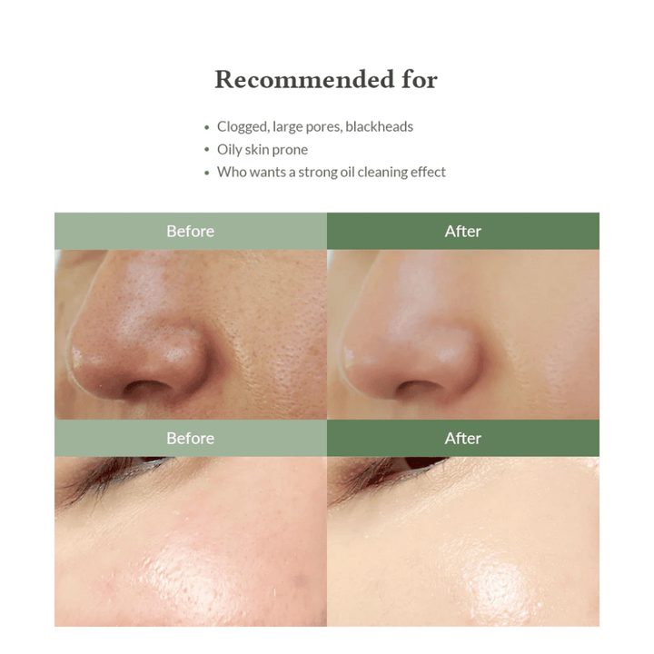 Dr. Althea Premium Quick Step Sebum Cleanser – čistilo za obraz, ki pomaga zmanjšati ogrce, globinsko očistiti pore in zagotoviti enakomernejšo strukturo kože.