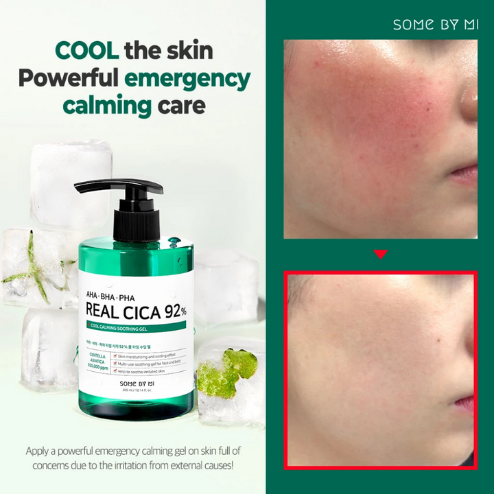 Močna akutna pomirjujoča nega za kožo s SOME BY MI AHA, BHA, PHA Real Cica 92% Cool Calming Soothing Gel 300ml.
